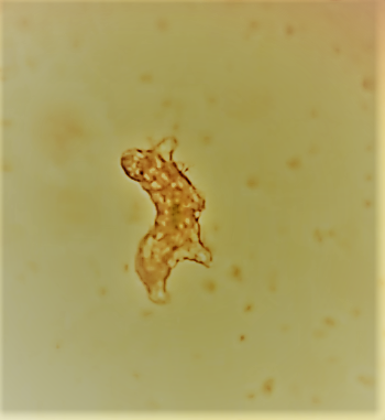 Processed micrograph emphasizing tardigrade morphology